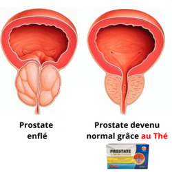 Prostate Tea : Thé contre la prostate et la Faiblesse Sexuelle